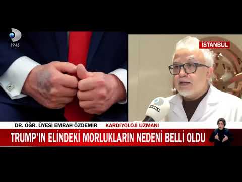 Gelişigüzel Aspirin Kullanımı Neden Tehlikelidir? Aspirin Kimler İçin Faydalı, Kimler İçin Riskli?