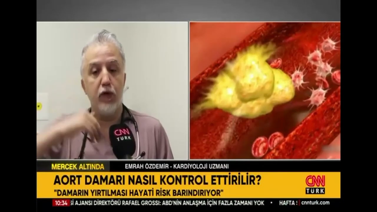 Aort Damar Genişlemesini Nasıl Tespit Ederiz?